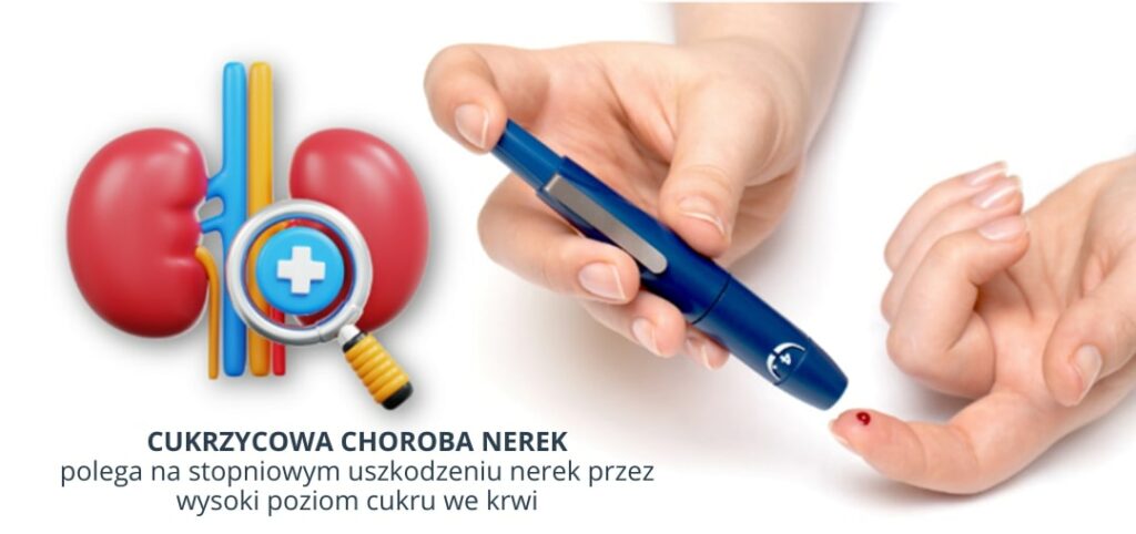 Nerki oraz rece nakluwane w celu sprawdzenia poziomu cukru